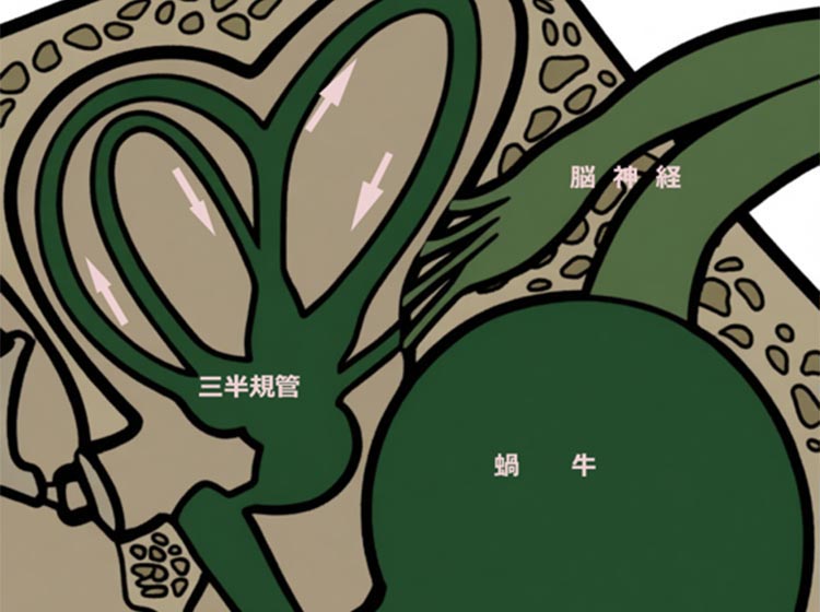 耳が原因のめまい